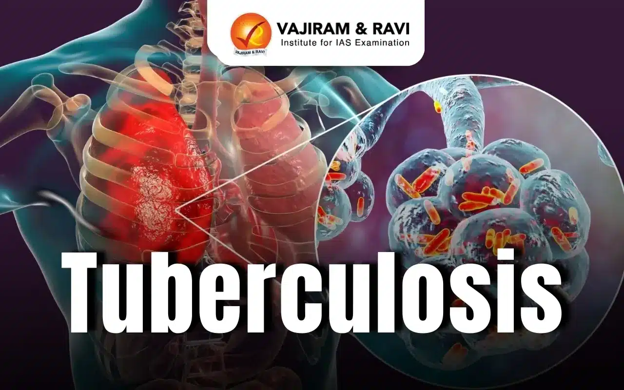 Tuberculosis (TB)