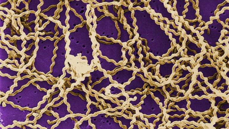 What is Leptospirosis?