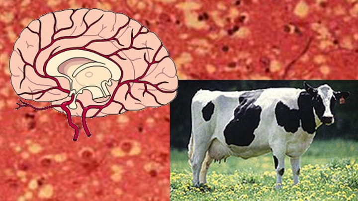 What is Mad Cow disease?