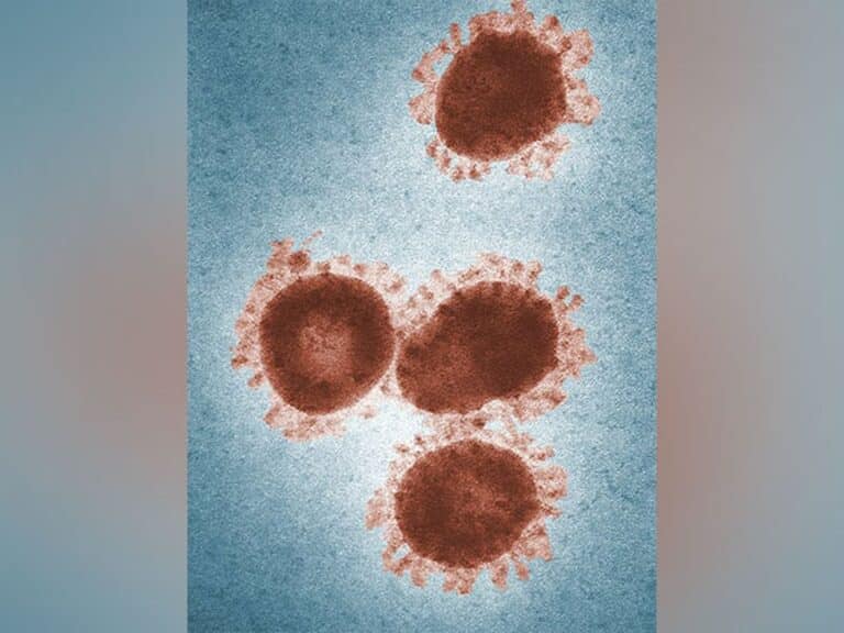 “Zombie viruses'' revived from Russia’s Siberian permafrost