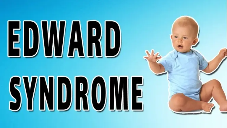 Edwards syndrome