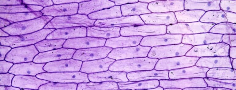 What is Epidermis?