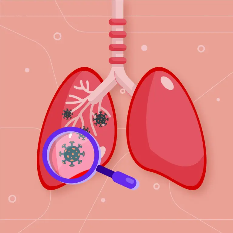 Extra-pulmonary TB