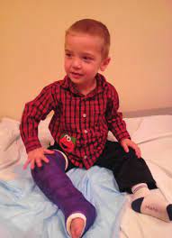 Infantile Hypophosphatasia