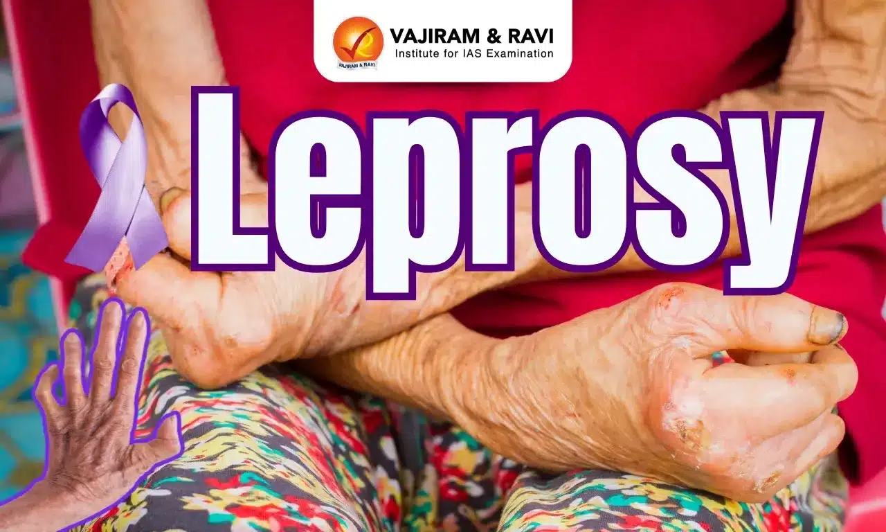 What is Leprosy?