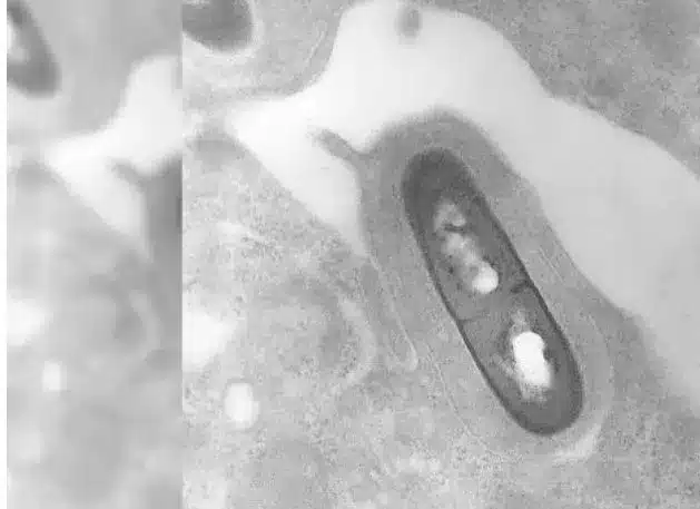 Listeria Outbreaks in the US and Canada: Causes, Symptoms, and Prevention