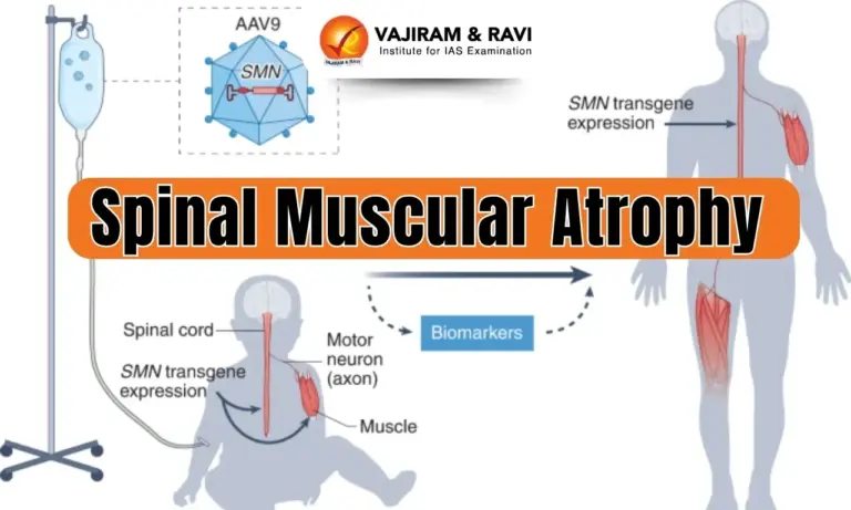 Spinal Muscular Atrophy