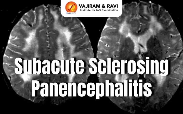 Subacute Sclerosing Panencephalitis (SSPE)