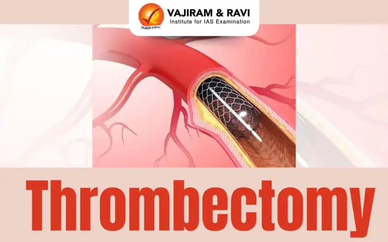 Thrombectomy