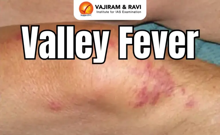 Valley Fever