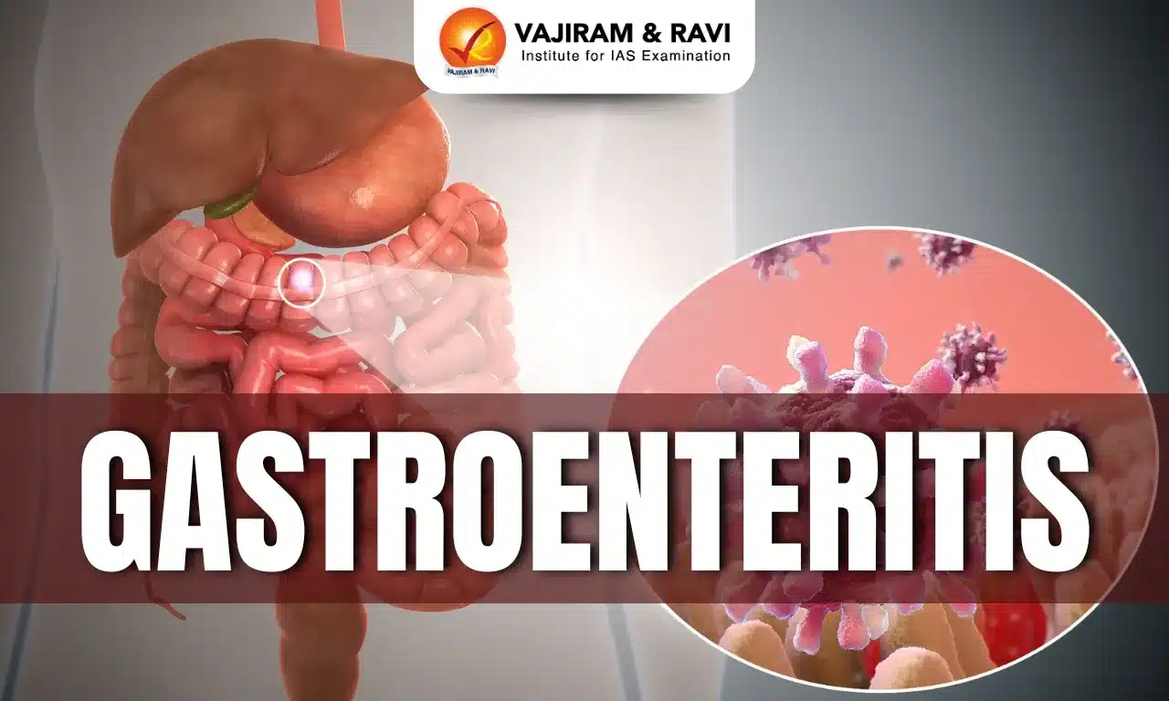 Gastroenteritis