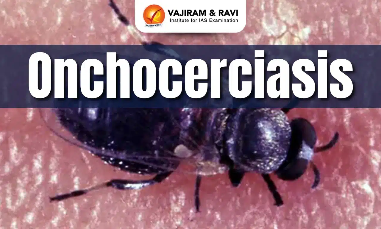 Onchocerciasis