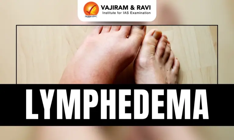 Lymphedema