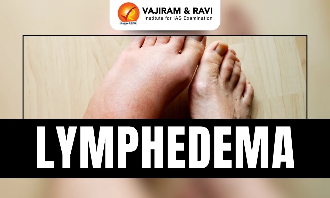 Lymphedema