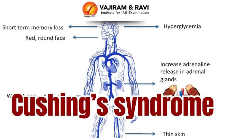 Cushing’s Syndrome