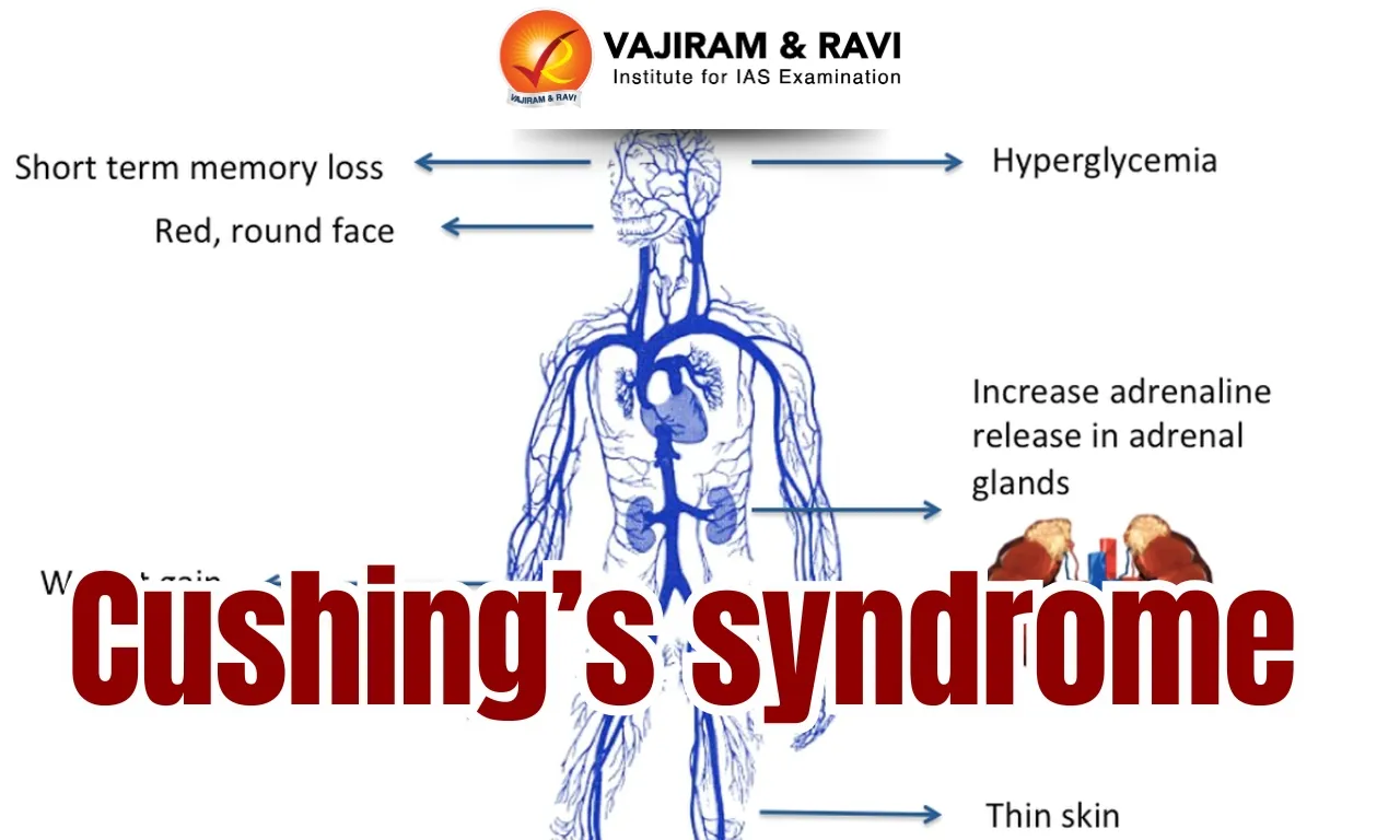 Cushing’s Syndrome