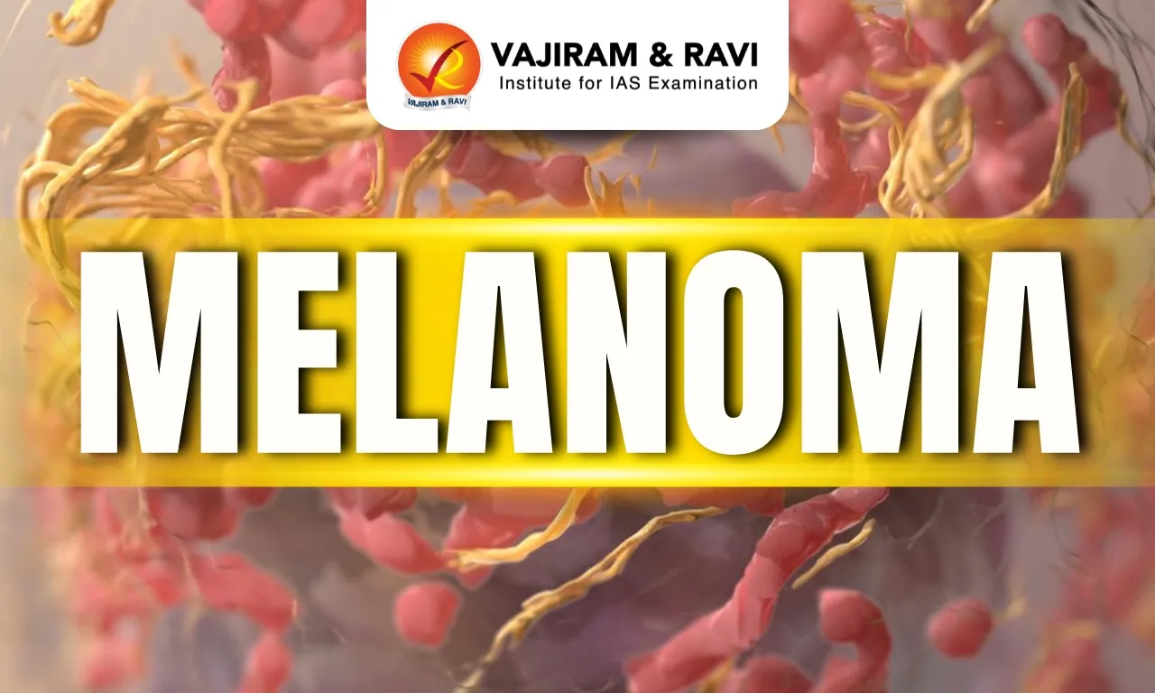 Melanoma