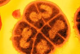 What is Deinococcus radiodurans